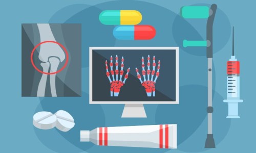 Rheumatoid Arthritis ( रूमेटाइड आर्थराइटिस )