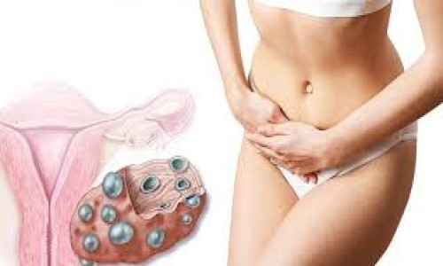 hormonal disorders (हार्मोन डिसऑर्डर)